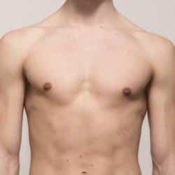 Orlando FL Plastic Surgery for Men