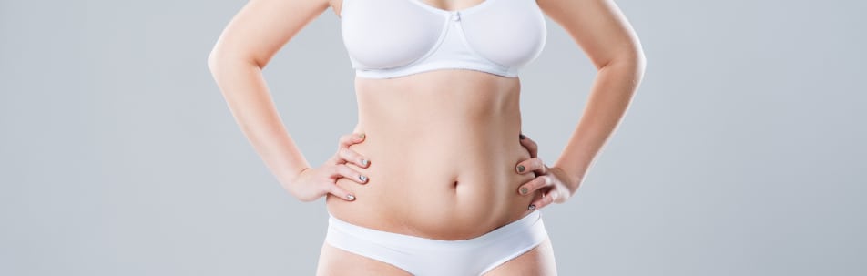 Fleur-De-Lis Tummy Tuck  Hillcrest Plastic Surgery