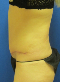 After Image
