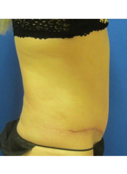 After Image