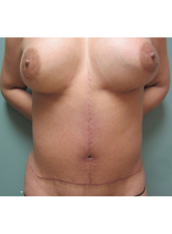 After Image