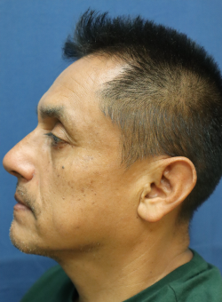 After Image