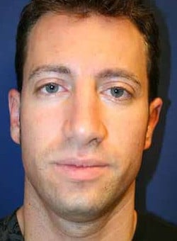 After Image