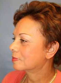 After Image