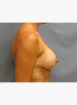 After Image