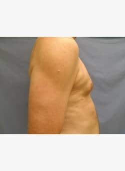 After Image