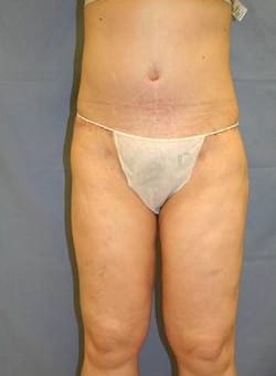 After Image