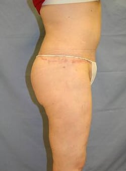 After Image