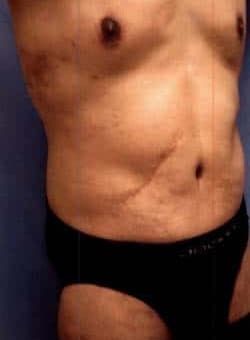 After Image
