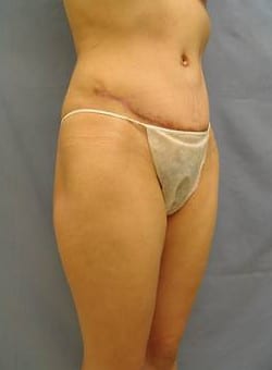 After Image