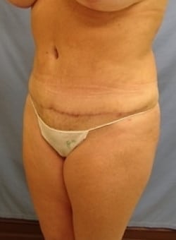 After Image