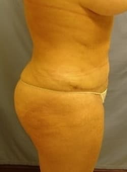 After Image