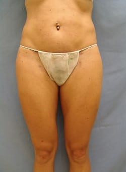 After Image