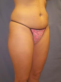 Before Image