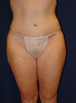 After Image