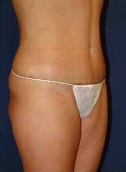 After Image