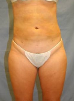 After Image