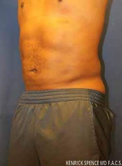 After Image