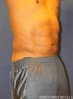 After Image