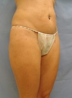 After Image