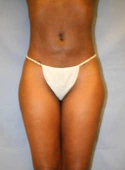 After Image