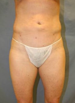 After Image
