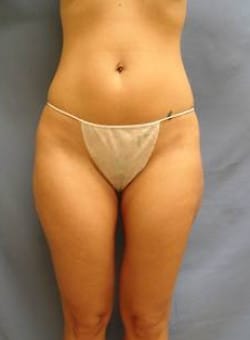 After Image