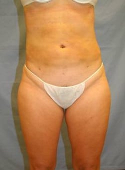 After Image