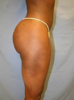 After Image