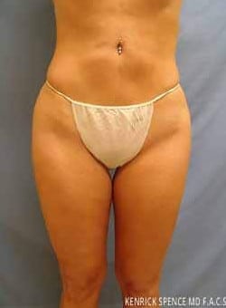 After Image