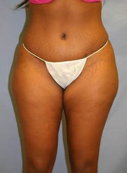 After Image