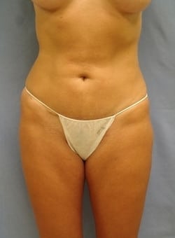 After Image