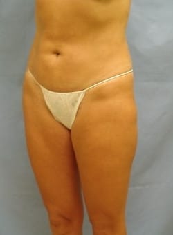 After Image