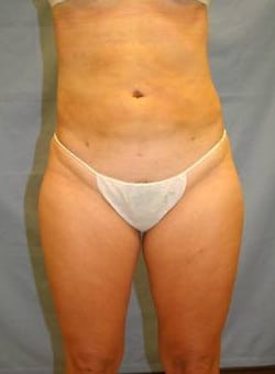 After Image