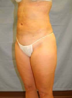 After Image