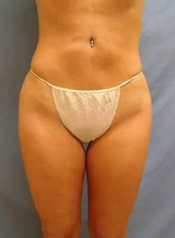 After Image