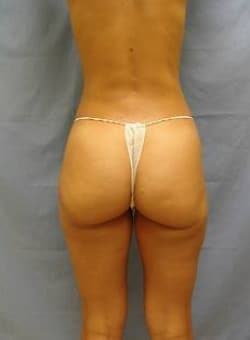 After Image