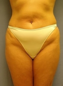 Before Image