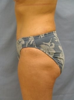 After Image
