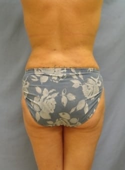 After Image