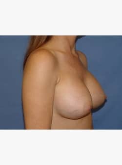 After Image