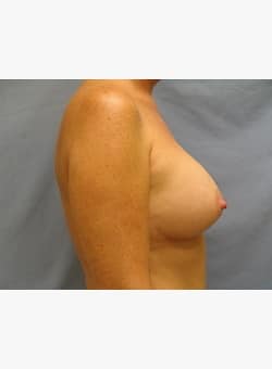 After Image