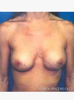 After Image