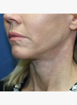 After Image