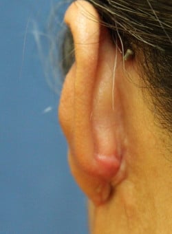 After Image