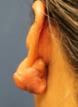 Before Image