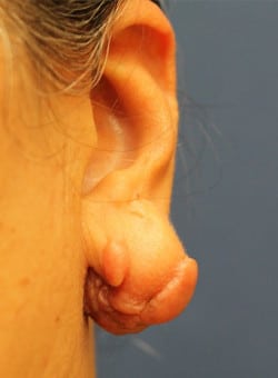 Before Image