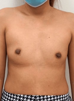 Before Image