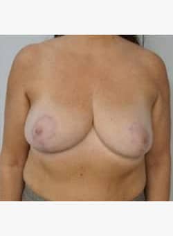 After Image