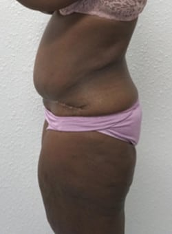 After Image